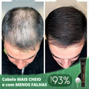 Regrowth™ - Óleo de Crescimento Capilar